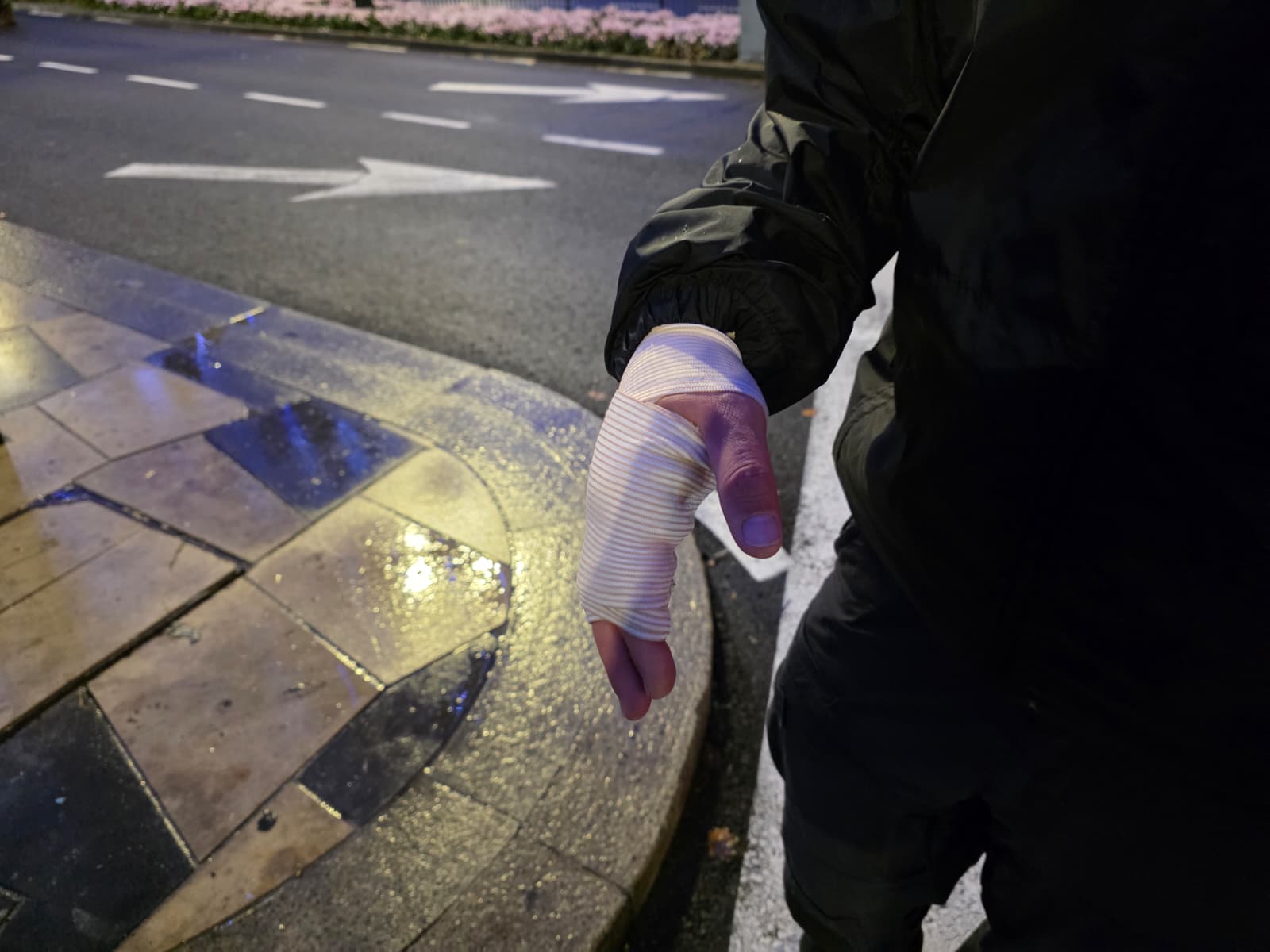 שוטרים נפצעו קל | דוברות המשטרה