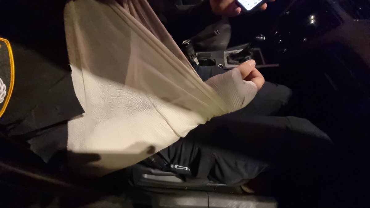 השוטר הפצוע | דוברות המשטרה