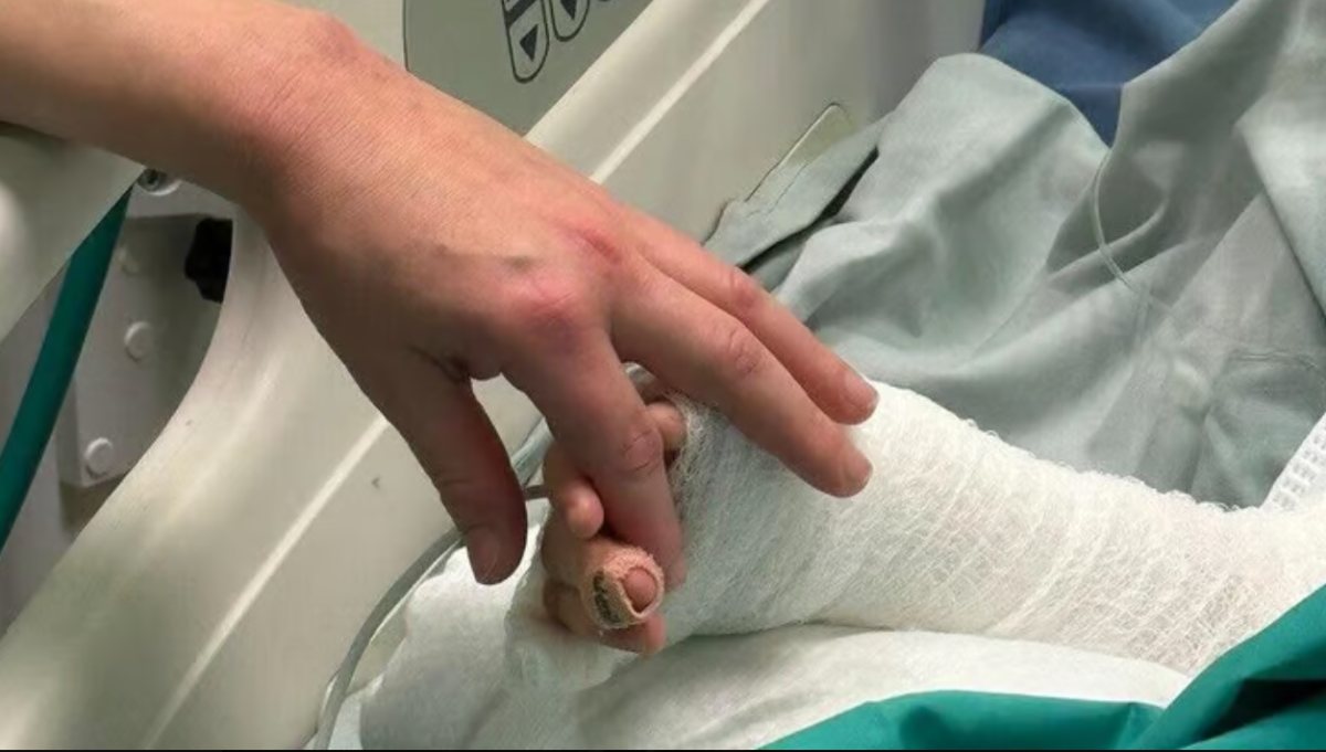 הילד נכווה קשות | צילום: הדסה עין כרם