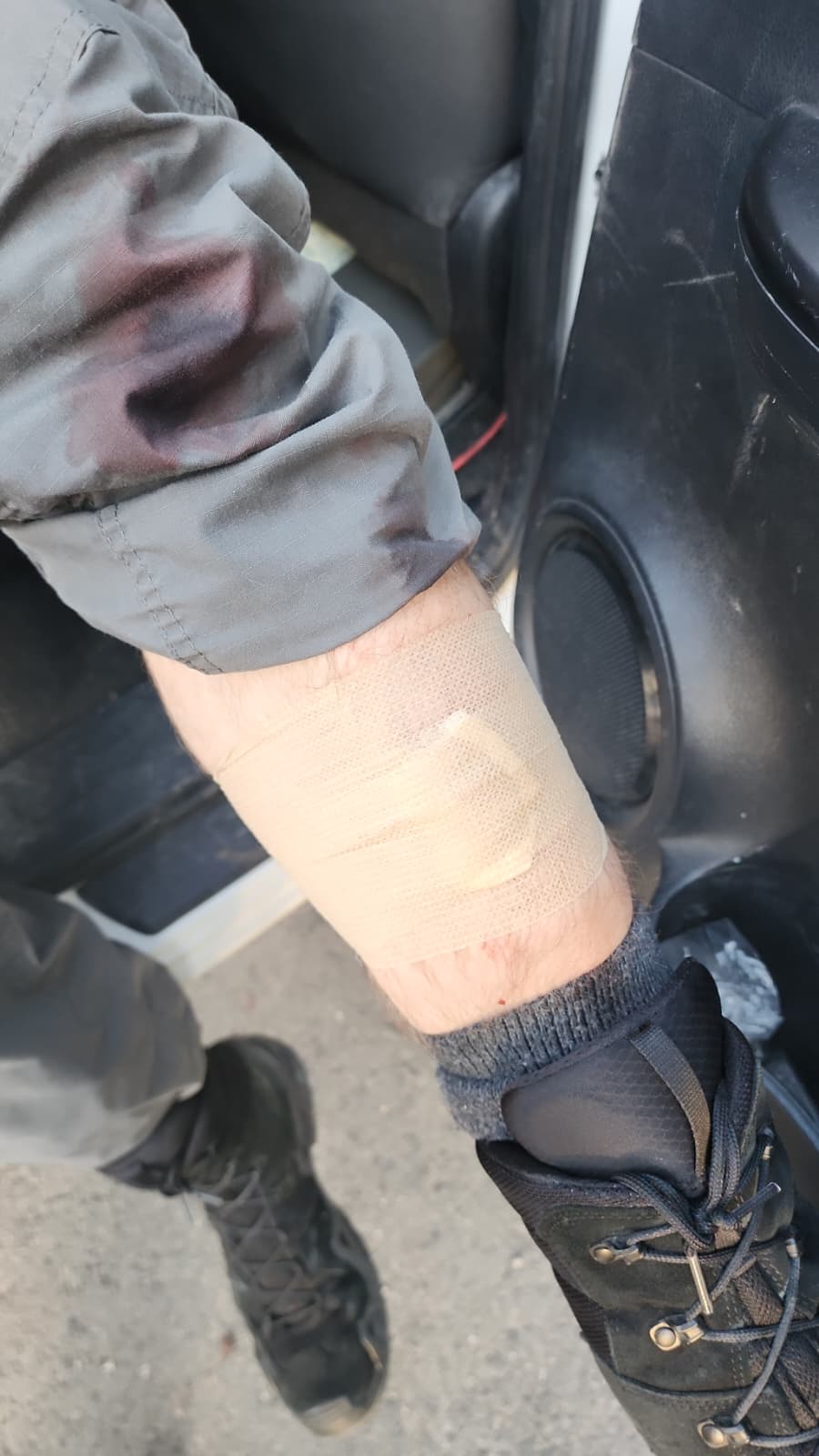 שוטר שנפצע בהפגנה האלימה | דוברות המשטרה