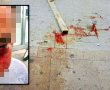 נפצע מקרש שנפל מאתר בנייה ואיבד הכרה: "הפנים שלו התנפחו, מלא דם על הרצפה"